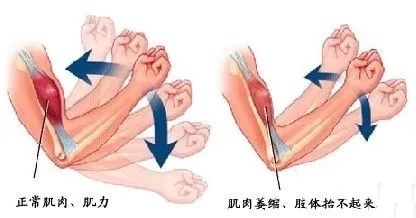 男性年龄影响借卵供卵代怀医院的成功率吗？