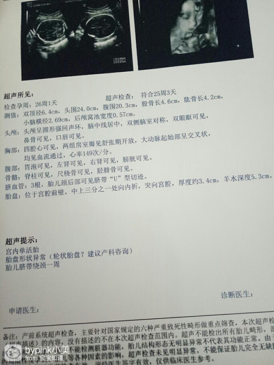 哪些因素影响代生男宝代怀男孩移植的成功？这几种一定要注意,这样做才对!