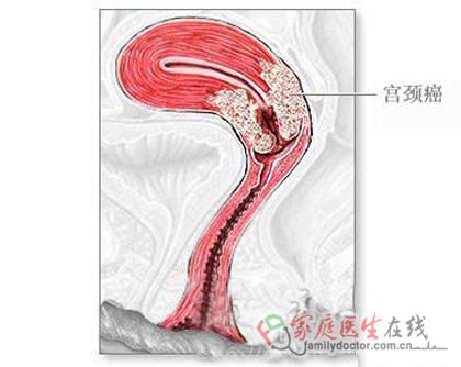 北京代怀代生儿子缺点一二三代供卵试管代怀有哪些技术那个更好？该如何选择？