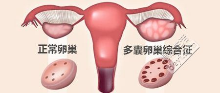试管降调期间可以喝中药调理吗